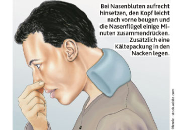 Hochsaison für Nasenbluten » Dr. Stefan Edlinger | Dr. Stefan Edlinger